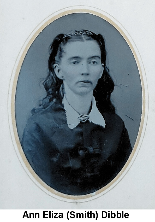 Ann Eliza (Smith) Dibble; blue-tinted monochrome cameo portrait photo of a thin young woman with a sadly downturned mouth and long dark hair in pigtails held back by a ribbon, wearing a dark satin dress with a white collar
